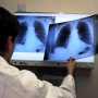 В марте в Крыму будут усиленно бороться с туберкулезом