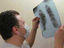 Реализация программы по борьбе с туберкулезом снизит показатель заболеваемости, – Минздрав