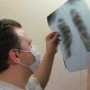 Реализация программы по борьбе с туберкулезом снизит показатель заболеваемости, – Минздрав