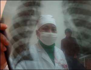 В курортной Алуште превышен эпидпорог по туберкулёзу
