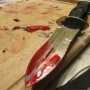 Посетитель кафе в Евпатории получил удар ножом от приятеля