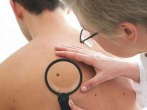 Как уберечься от рака кожи?