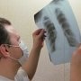 Заболеваемость туберкулезом в Феодосии снизилась на треть