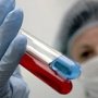 В Крыму ожидается появление нескольких вирусов гриппа