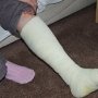 Турист из Павлограда сломал ногу в крымских горах