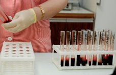 Студенты в Симферополе смогли сделать тест на ВИЧ