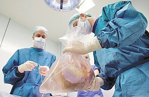 Сколько стоит пересадка органов в России?