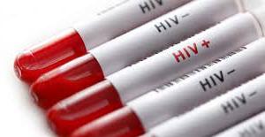 В Евпаторию поступит около 16 тысяч тест-систем для выявления ВИЧ-инфекции