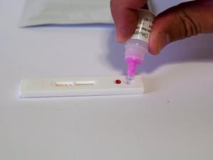 Тест-системы для выявления ВИЧ-инфекции между крымчан закуплены в полном объеме, — Немыкин