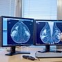 Бесплатную маммографию смогут пройти в Симферополе женщины старше 39 лет