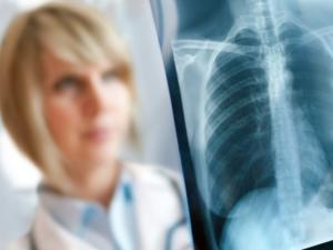 В Севастопольские больницы поступят новые маммографы и рентген аппараты