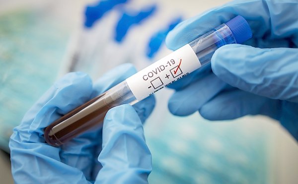 Рынок тестов на коронавирус заняли компании аффилированные с высшими чиновниками и олигархами