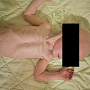 В Крыму приемная мама истощенного малыша обвиняет детдом в ненадлежащем уходе