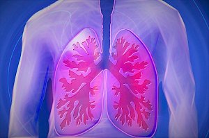 Обширное поражение лёгких при пневмонии не означает, что пациент обречён, — пульмонолог